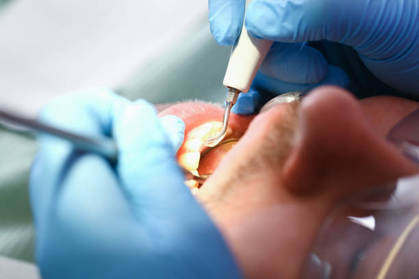 Best Emergency Treatment for Toothache in Fairbanks, AK