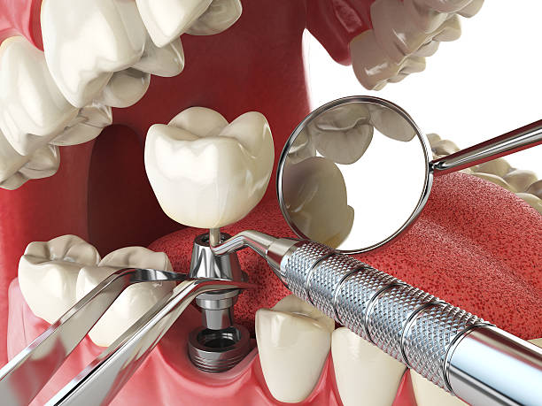Best Pediatric Emergency Dentist in Fairbanks, AK